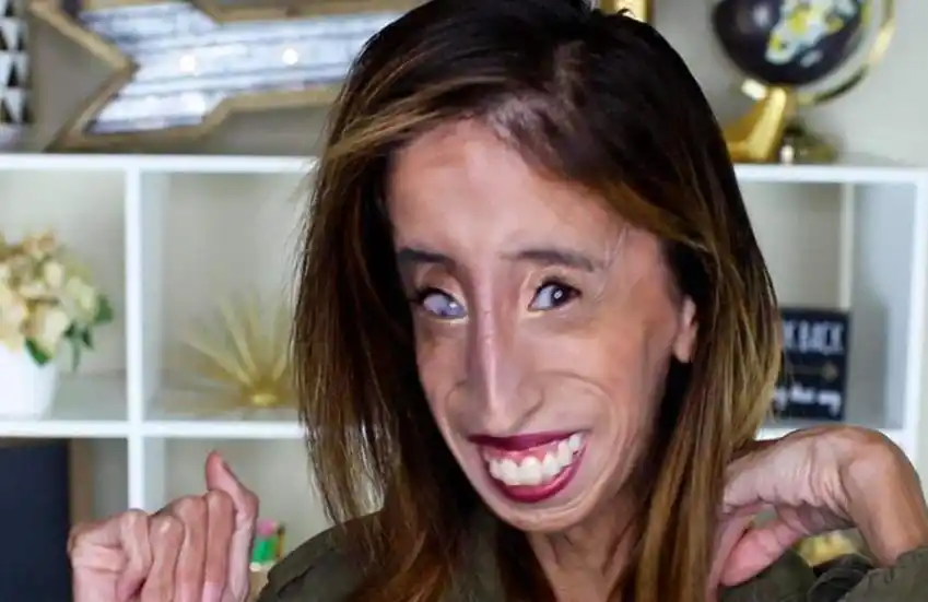 世界上最丑的女人帅哥排着队追求看完你也觉得高攀不起