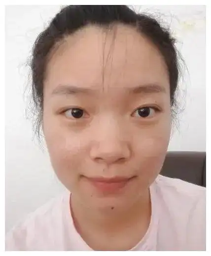 女人面相下巴痣,四分善,六分恶!甚至影响到生育,难产,流产!