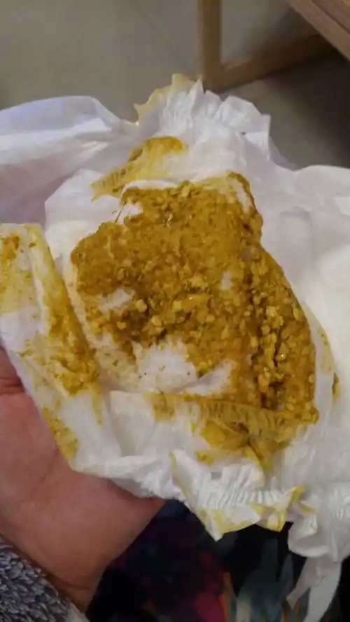 百度知道用户   2015-04-25 21:34 其他回答 宝宝有点消化不良,奶粉