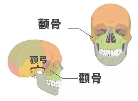分享颧骨高和宽的区别图,教你如何正确让颧骨变小!
