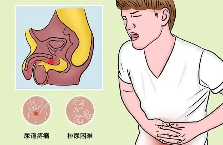 赣州现代泌尿专科医院怎么样排尿的时候尿道疼是怎么回事