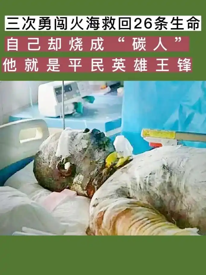 三次勇闯火海救回26人,自己却被烧成炭人,不幸去世,他就是平 - 抖音