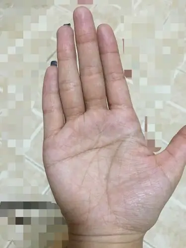 本人女,右手断掌 ,可以帮忙分析一下整个右手的掌纹嘛?