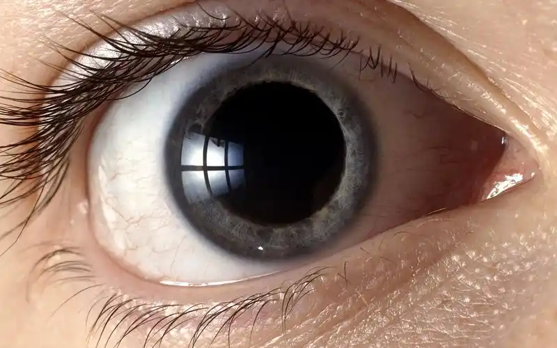 暗环境下的超大瞳孔系列特写