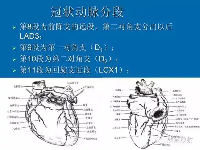 cta解剖名称缩写冠状动脉分支解剖左,右冠状动脉介绍心脏系统解剖图