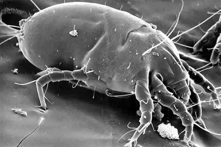 1)粉尘螨:扫描电镜下的螨虫↓污物里的粗脚粉螨↓屋尘螨 d.