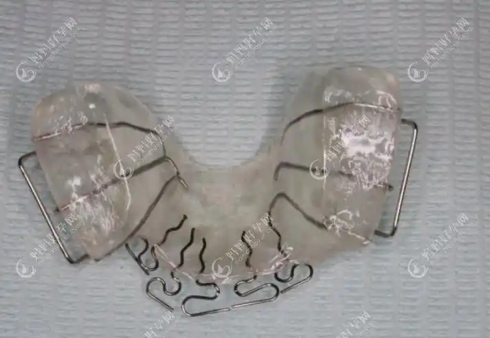 4岁儿童地包天矫正费用及牙套种类分享,3-12岁孩子同样适用