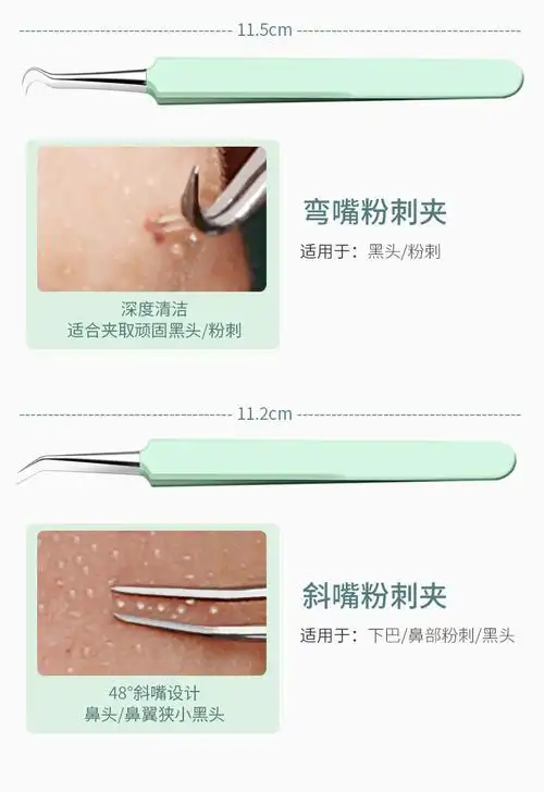 精选直发粉刺针套装祛痘去黑头针细胞夹挑挤痘痘美容院工具暗疮针古莎