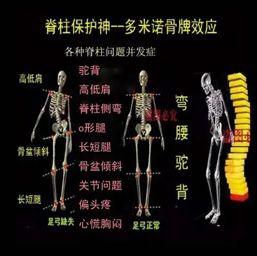 德国立能矫正驼背脊柱侧弯护颈腰胸椎关节痛长短腿型矫正器娇姿带