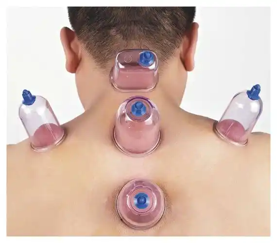 养生方法—拔罐_气血_身体_治疗