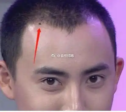 发际线上有痣的男人是非常纯情的物种,然而很难遇到两情相悦的人,遇到