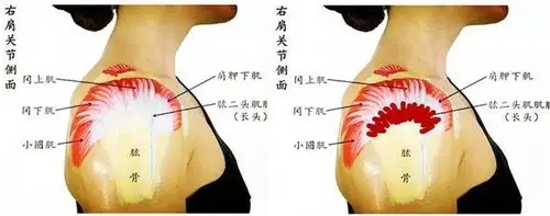 神龙上古堂肩周炎康复案例