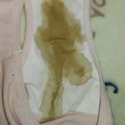 今天一天没吃饭又哭了一天,晚上流了大量褐色分泌物,内裤都湿透了,这