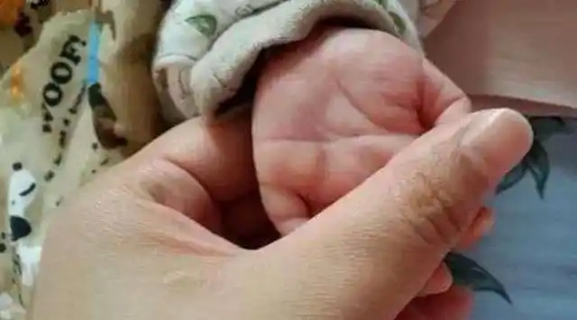 宝宝双手断掌就一定是唐氏儿?关于"断掌"的这些事,父母要知道