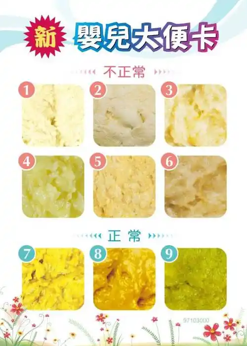 新生儿大便颜色怎样才算正常?(附有图片辨别)【蘑菇学堂】