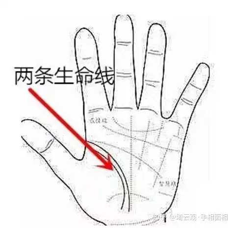生命线旁边另有一条这是两条生命线吗