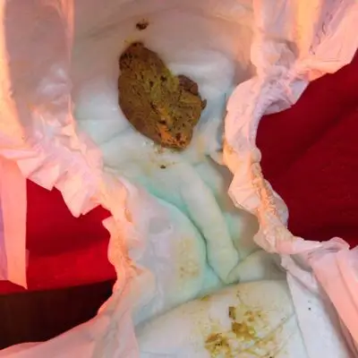 宝宝马上6个月了,自从添加辅食后,一天拉便便拉这样的好几次,不会一次