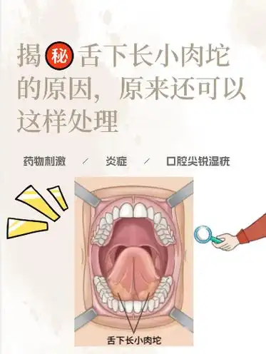 吃东西时不小心发现舌头下面长了个小肉坨,有些时候没有异常症状,有些