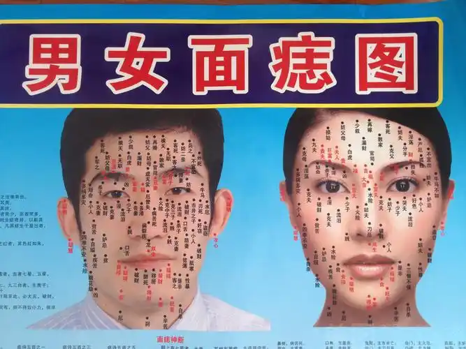 痣(单人)团购优惠券(图)-无锡美团网