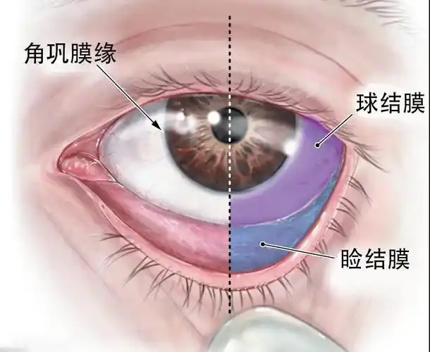 白眼球,也就是巩膜前面的那层,是球结膜.