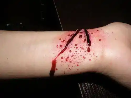 "和家人吵架后,少年往手腕割三刀,激动跳河自杀!