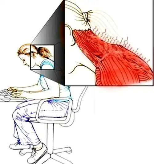 颈部疼痛来就诊,但是只要查体会发现这些人群的肩部,背部肌肉都是尤其