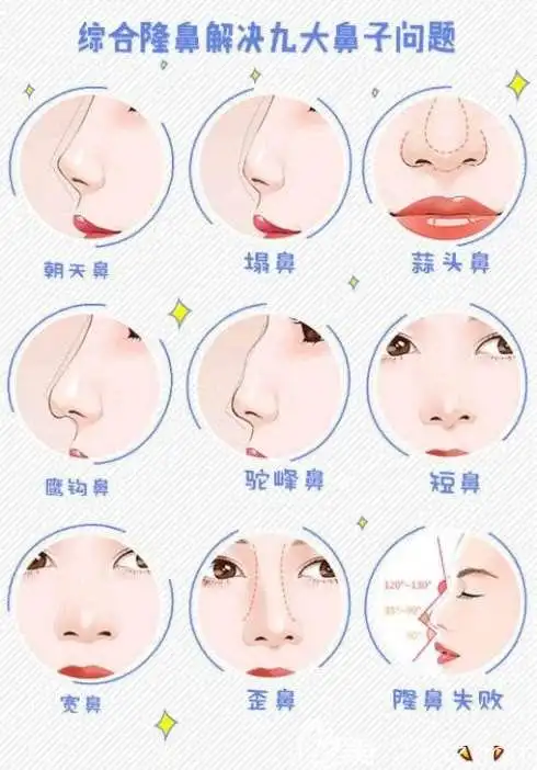 鼻综合可以解决的鼻部类型
