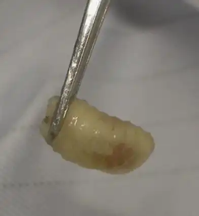 hominis),狂蝇科人皮蝇属动物,一种以人为寄生对象的蝇