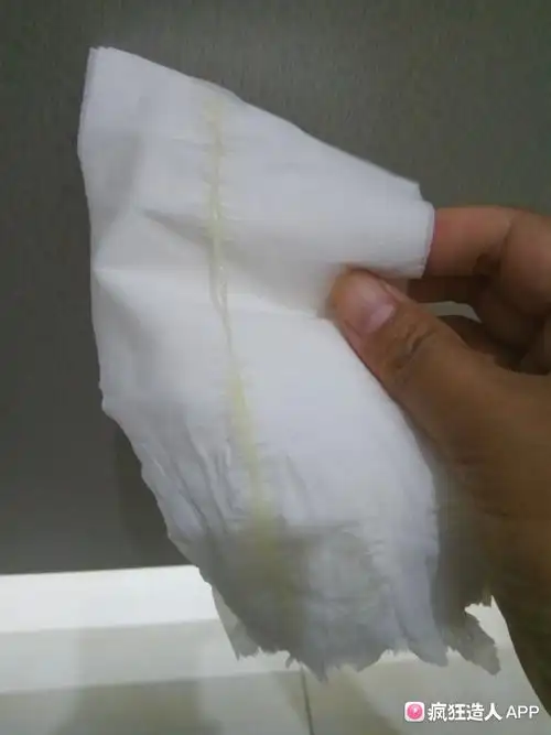 白带拉丝是排卵了吗?