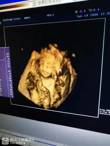 孕二十三周四维图