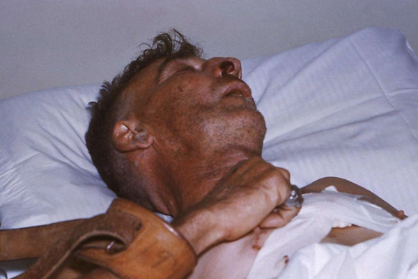 世界上真的有僵尸病毒吗埃博拉和狂犬病都是现实丧尸病