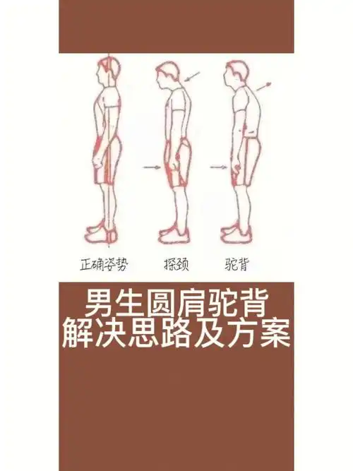 男生圆肩驼背体态改变