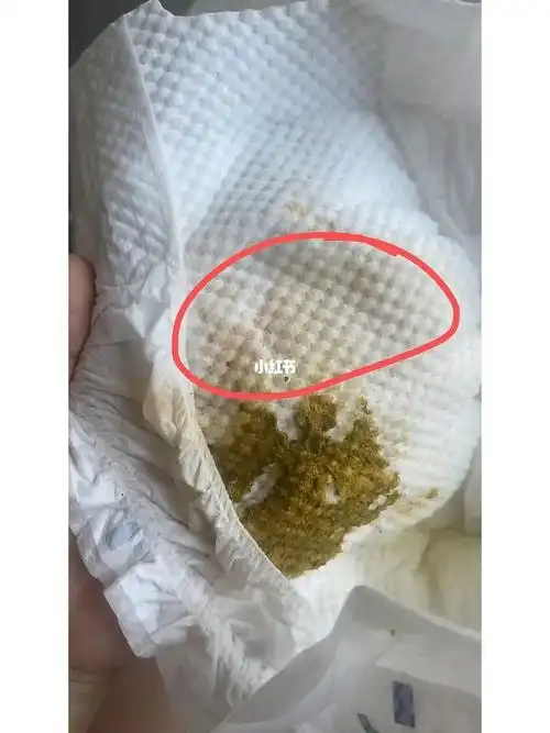 宝宝拉肚有点水便分离现在有这个淡粉色的