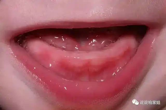 关于宝宝出牙的那些事儿|宝宝|牙龈|果果_新浪新闻