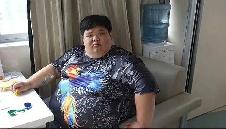 巨胖小伙腹围2米,成功减肥200多斤,小伙:医生送了条狗来遛我