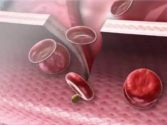 组织修复三维医学仿真动画