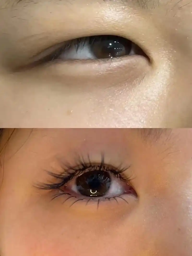 美睫作品 内双肿泡眼嫁接后堪比做双眼皮#美睫 - 抖音