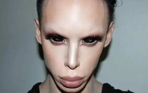 世界十大整容失败案例口味略重胆小者慎入有图