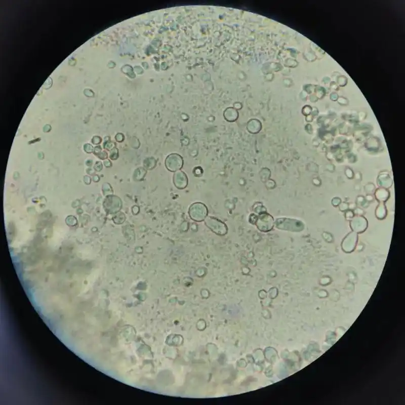 生物实验素材9|显微镜下酵母菌的出芽生殖