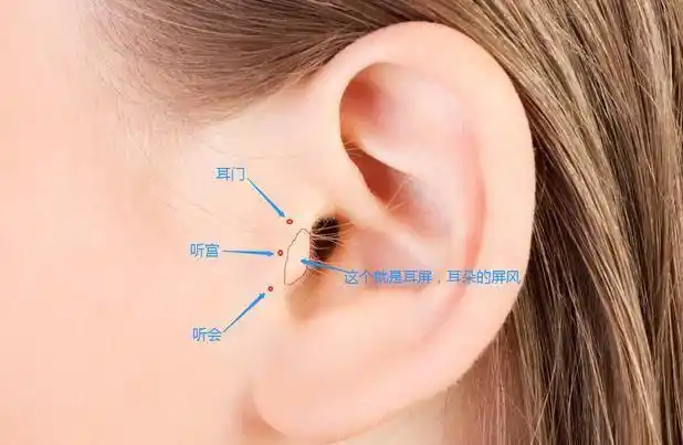 听宫具体在面部,耳屏前,下颌骨髁状突的后方,张口时凹陷处.