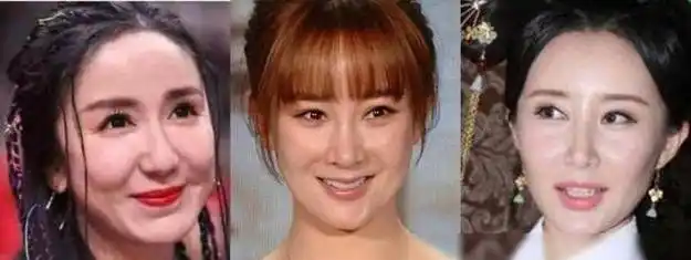 表面"貌若天仙",实则"歪瓜裂枣",这6位女明星整得太惊艳|整容_网易