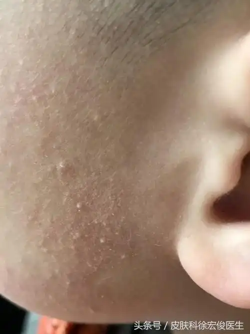 脸鸡皮肤洗面奶(关于三的成语故事)