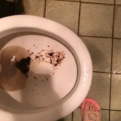 上图了,恶心的就别看了,希望大家别介意,就想问问这是啥,不会是血吧