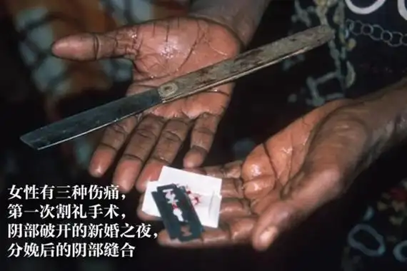 割礼是什么意思 - 割礼是什么 非洲女孩割礼 - 女性割礼是割什么?