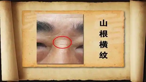 面相下巴中间有道横纹(面相下巴中间有道横纹好不好)