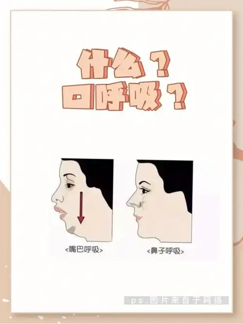 口呼吸真的不只是变成丑这么简单