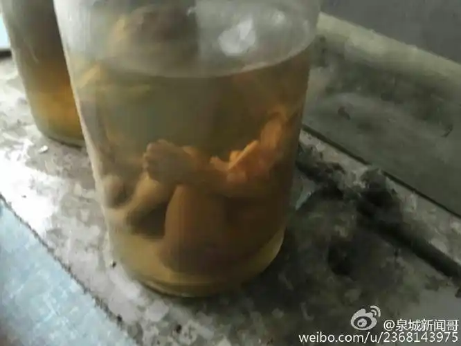 济南一诊所惊现多个婴儿标本