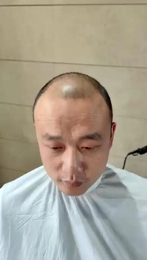 很多明星头发少或者脱发秃顶都会借助假发来达到完美发型,日常生活中