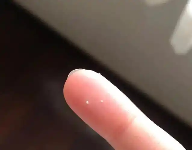 除了乳腺炎,缺奶少奶之外,乳头小白点也是一种常见的现象.