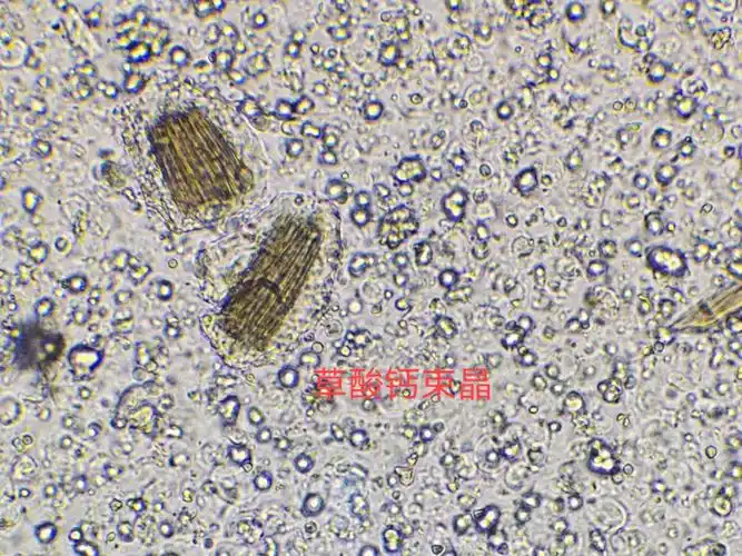 中药半夏粉末显微鉴定